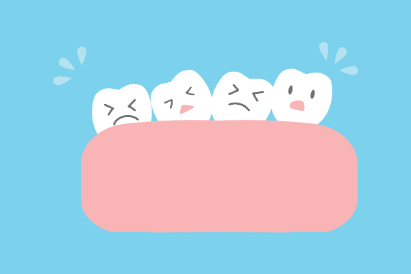 マウスピース矯正治療ができない歯並び