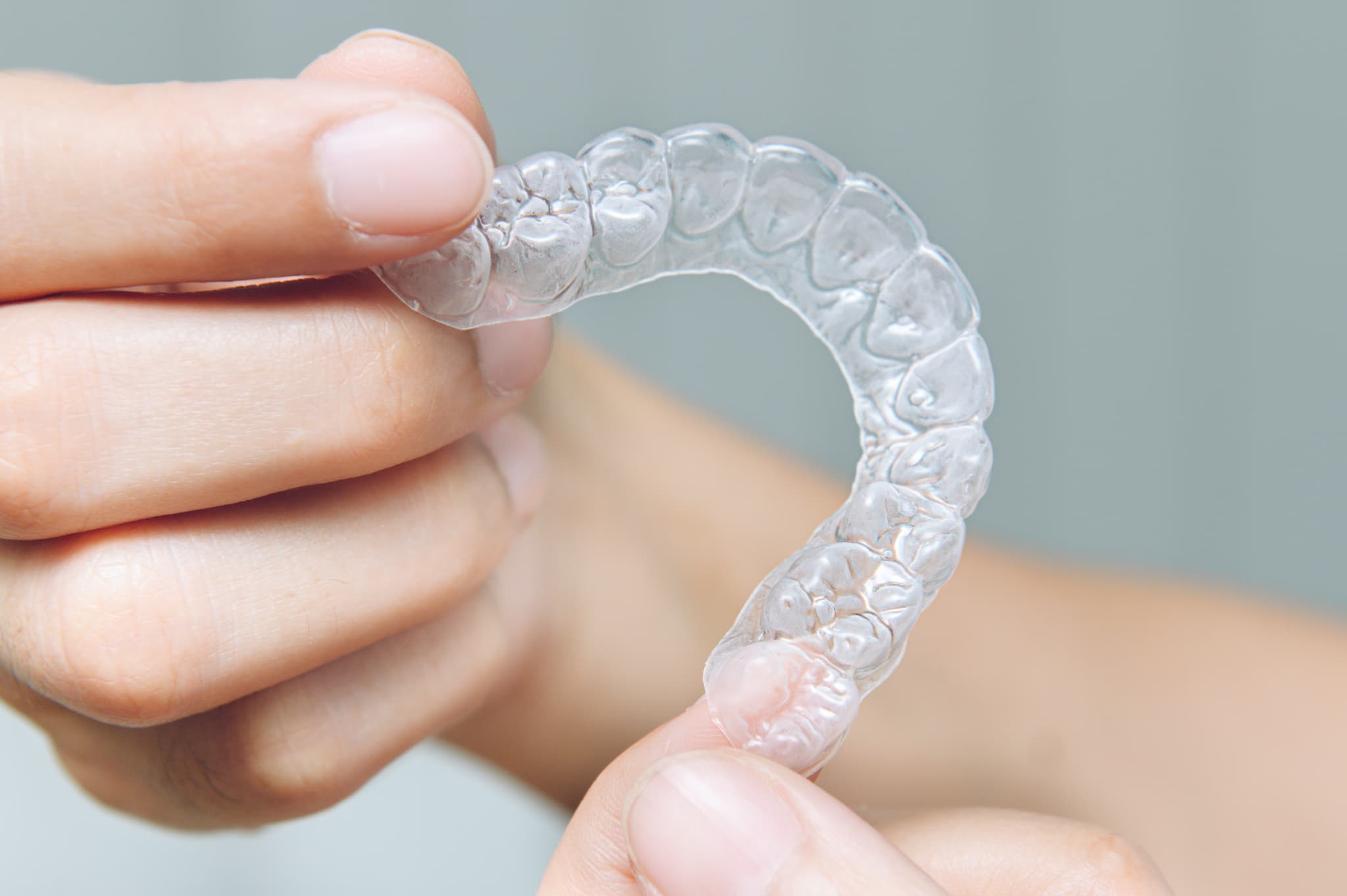 歯のJ矯正で使用するインビザライン