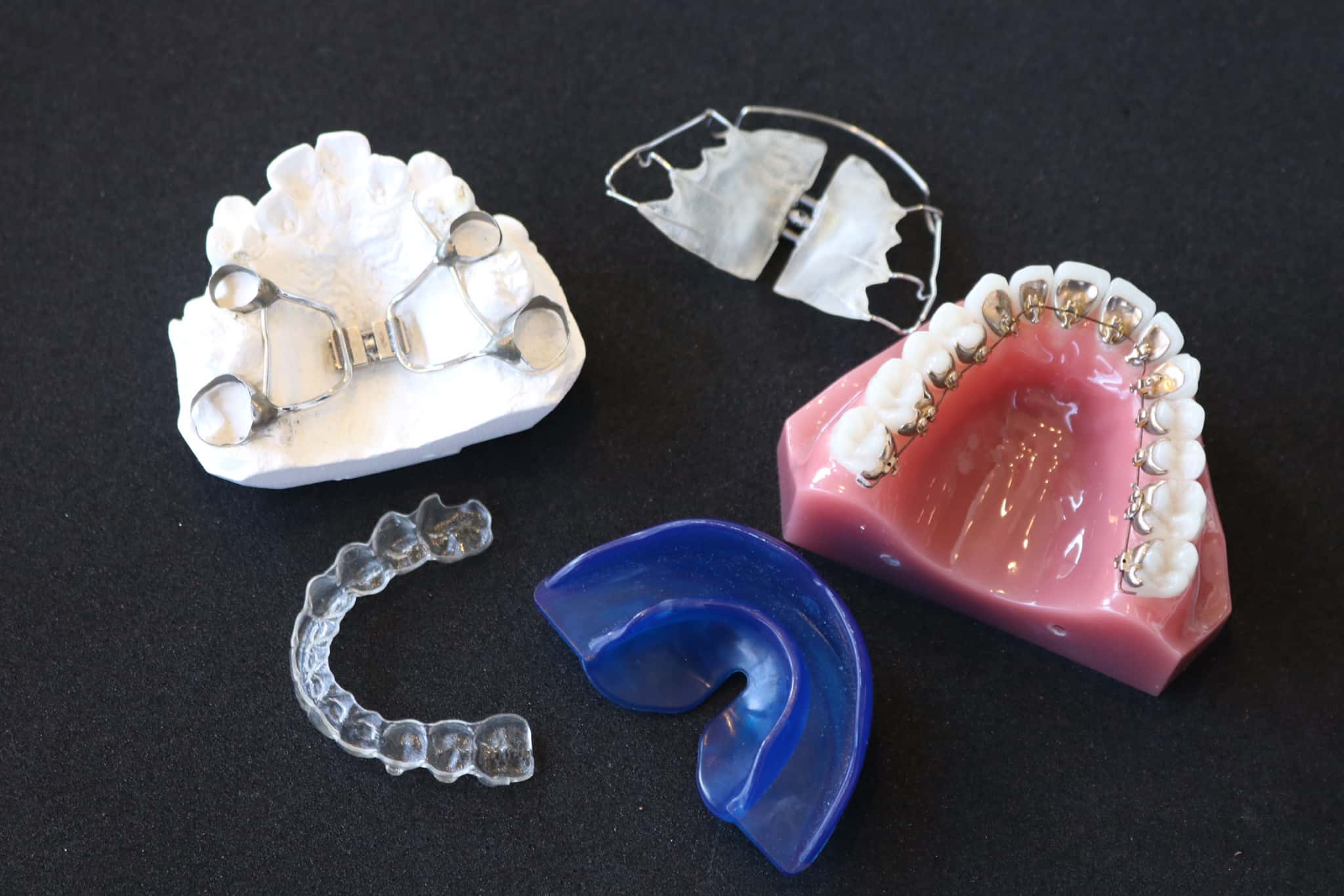 出っ歯を矯正するためのマウスピースなどの装置類